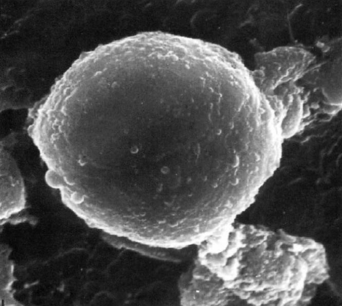 Megacariocita in soluzione di Melatonina al microscopio a scansione elettronica (3000x). Le evidenti protrusioni sono provocate dalle piastrine che si accingono a uscire.