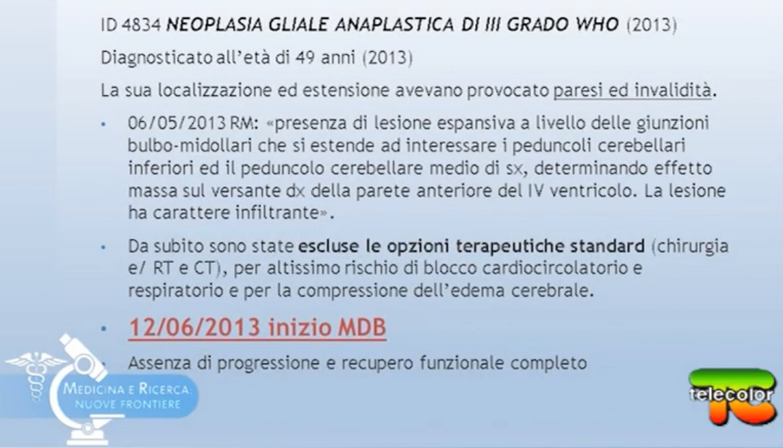 Neoplasia Gliale Anaplastica di Grado III° trattata solo ed esclusivamente con Metodo Di Bella (no chemioterapia, no radioterapia, no intervento chirurgico).